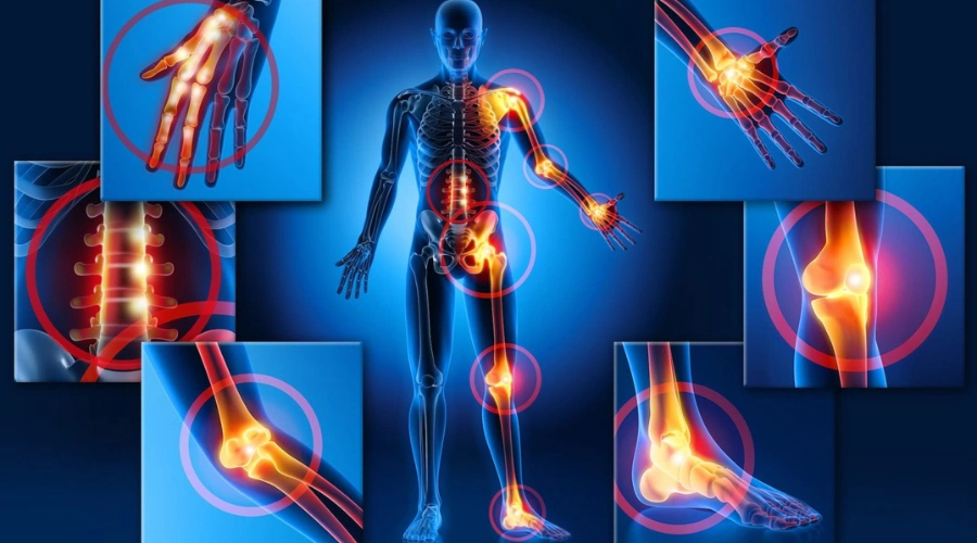 O que é Fibromialgia
